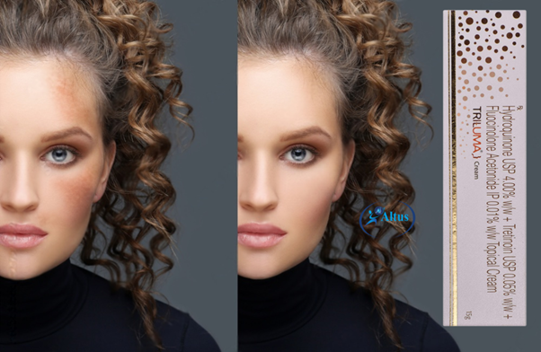 mxhtop_17a4d25ed662f0cc91b49e28944c147f.png