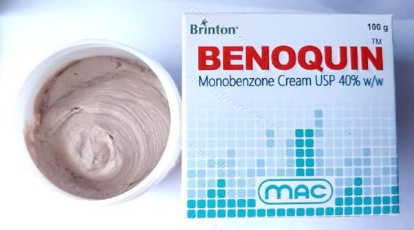 Benoquin Cream 20%: The Breakthrough Solution for Vitiligo You Need!