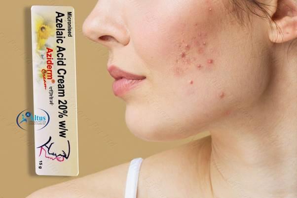Aziderm Cream 9