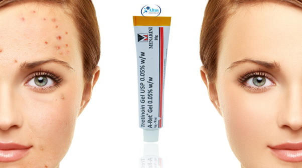 Acne Uncovered Pimples: The Startling Truth About Your Skin – Prepare to Be Amazed!
