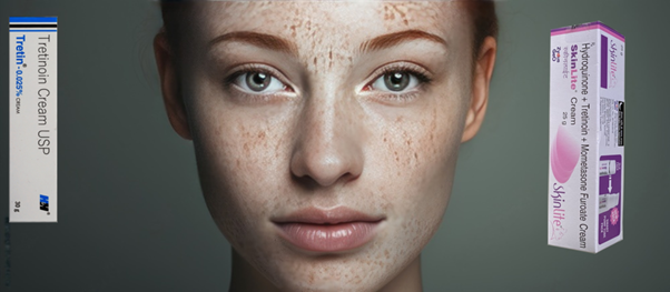 Acne Epidemic Alert! Learn the Alarming Facts You Need to Know!