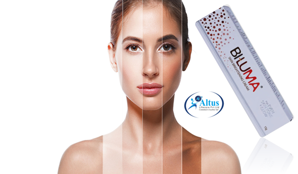 Say Goodbye to Dark Spots Forever with Biluma Cream – Try it Now!