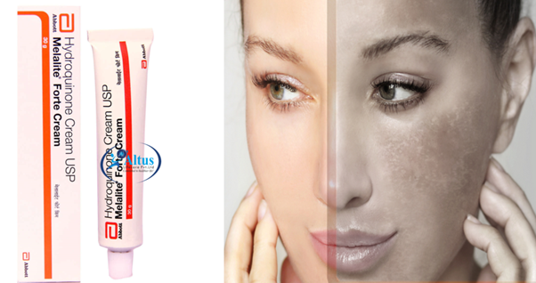 Hydroquinone Cream for Flawless Skin: Your Key to a Stunning Complexion!
