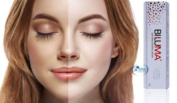 Say Goodbye to Dark Spots Forever with Biluma Cream – Try it Now!