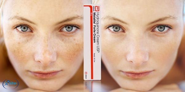 Hydroquinone Cream for Flawless Skin: Your Key to a Stunning Complexion!