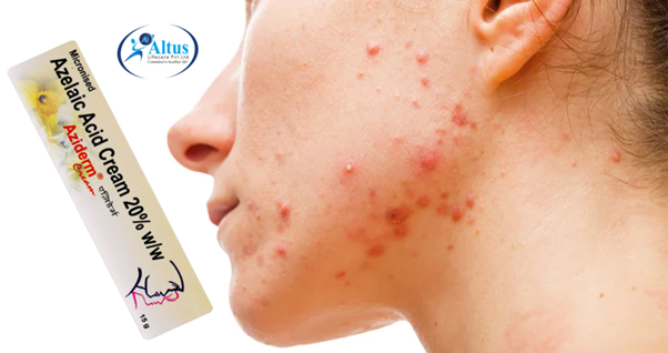 Aziderm 20 Cream: The Ultimate Solution for Beautiful Skin!